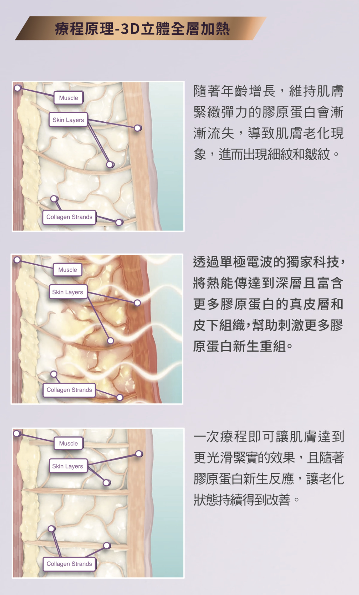 鳳凰電波療程原理