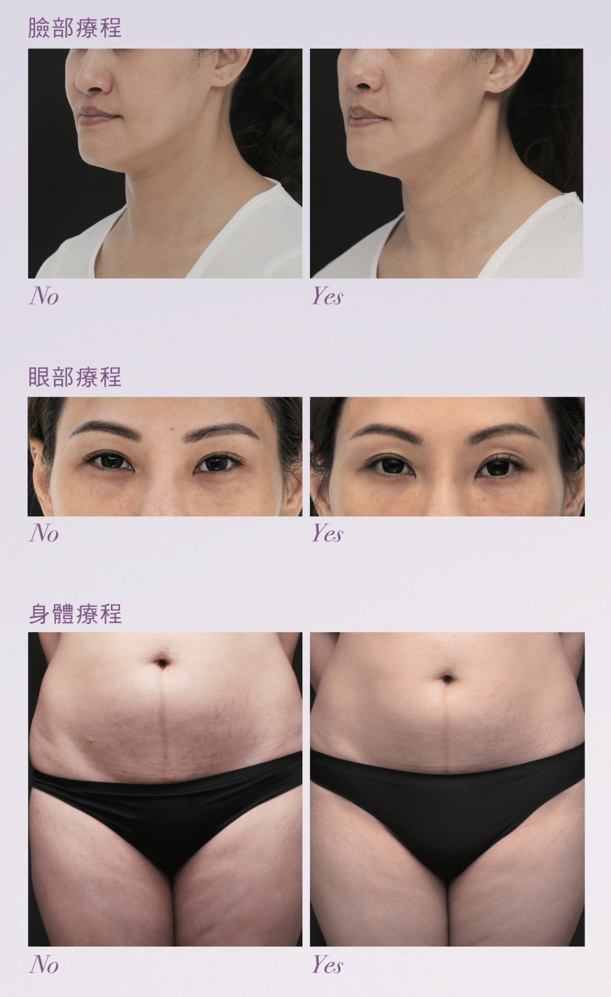 鳳凰電波＿療程前後對照