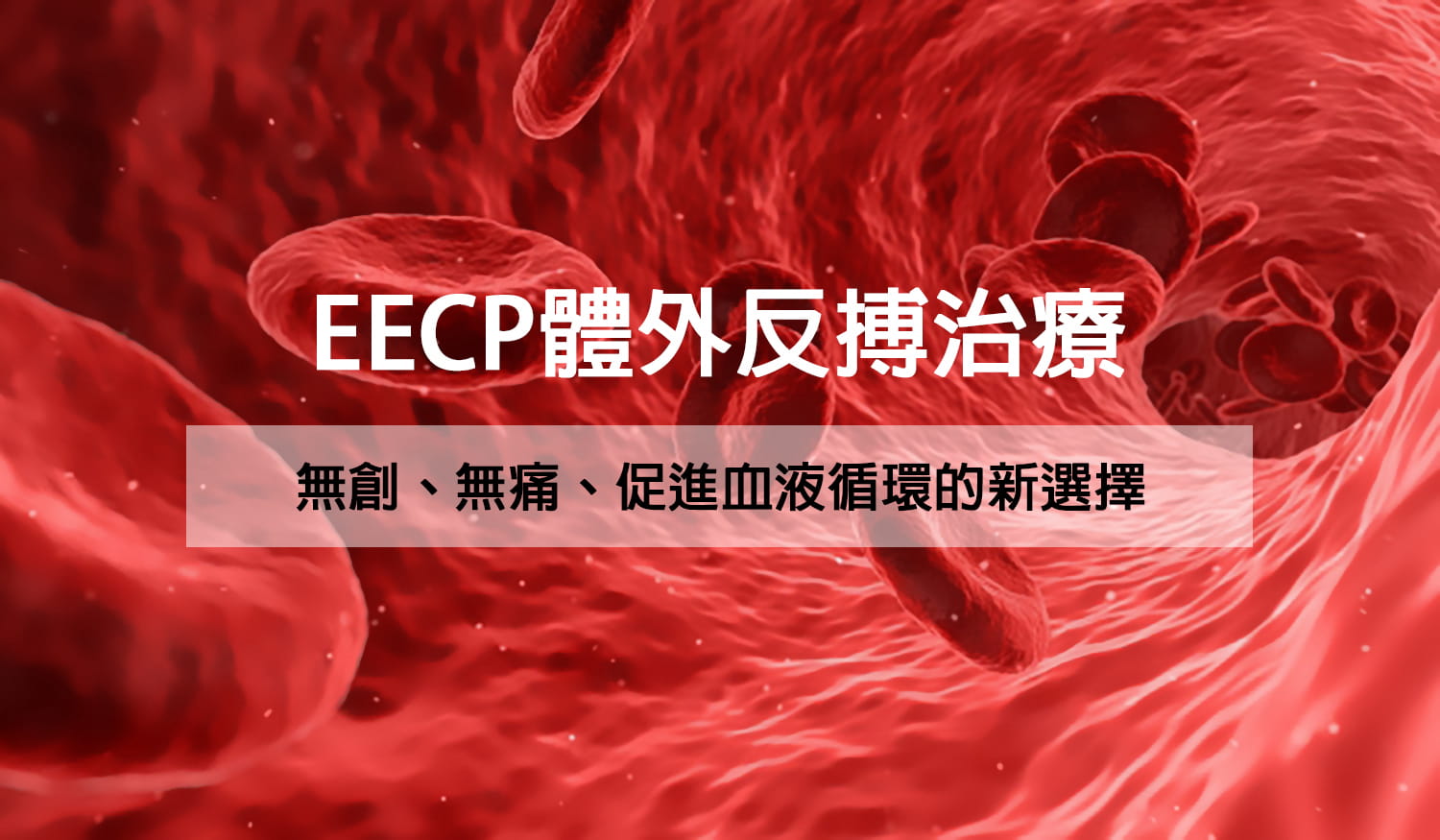 EECP不需開刀、不需住院，且無須長期依賴藥物