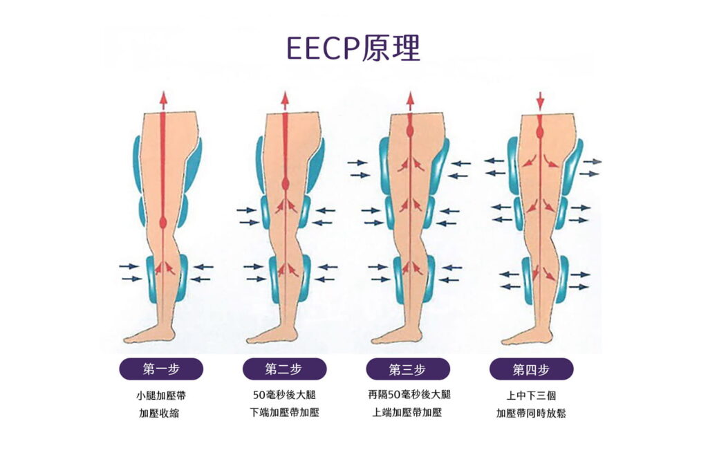 EECP原理