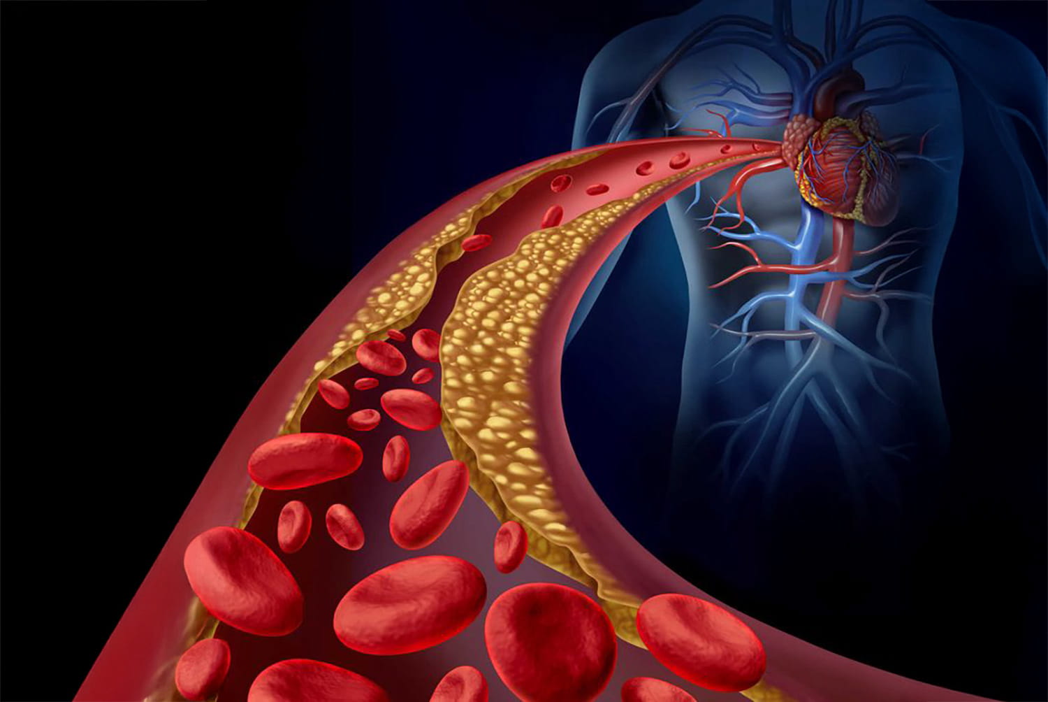 心血管疾病的早期症狀
