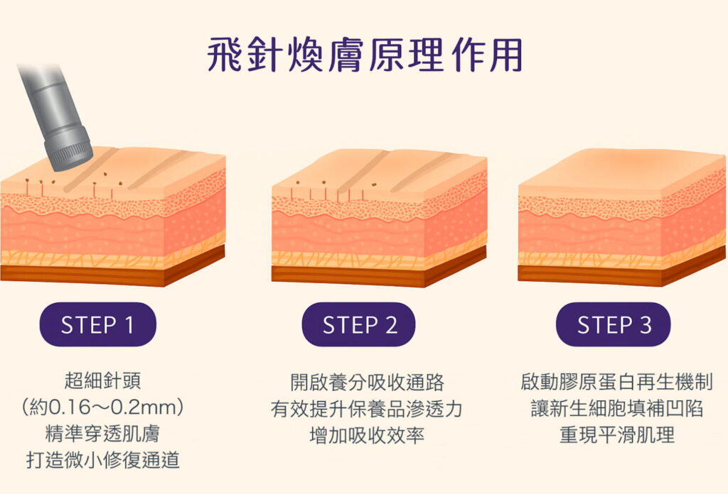 極緻飛針煥膚原理作用