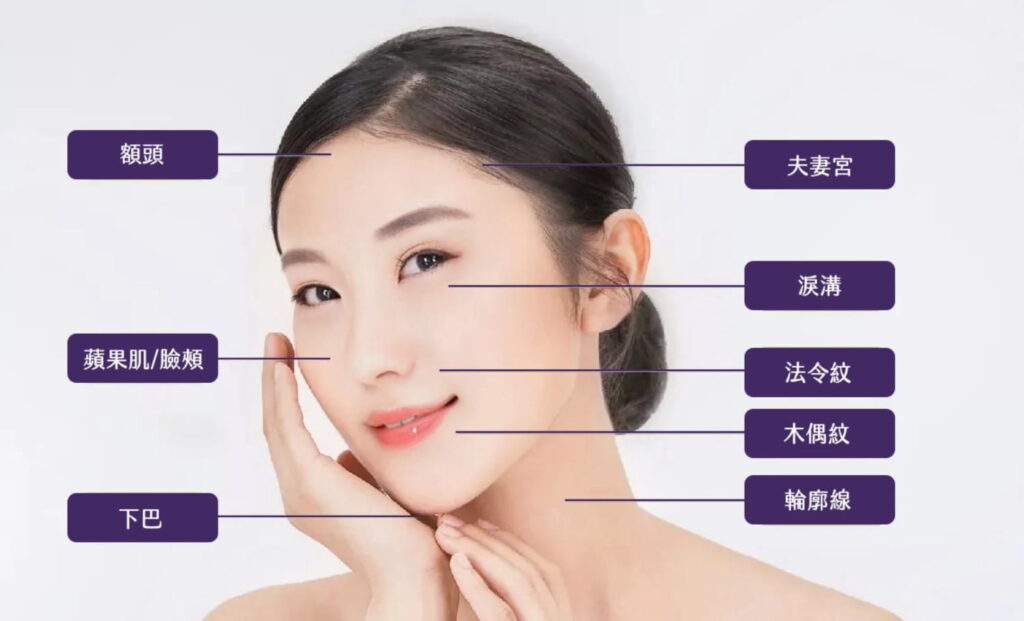 洢蓮絲施打部位2