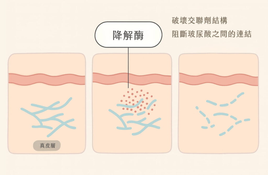 降解酶破壞交聯劑結構，阻斷玻尿酸連結
