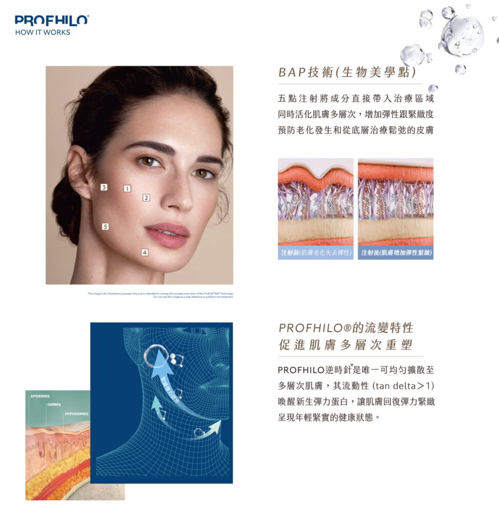 逆時針利用專利BAP五點注射策略，與皮膚組織自然融合