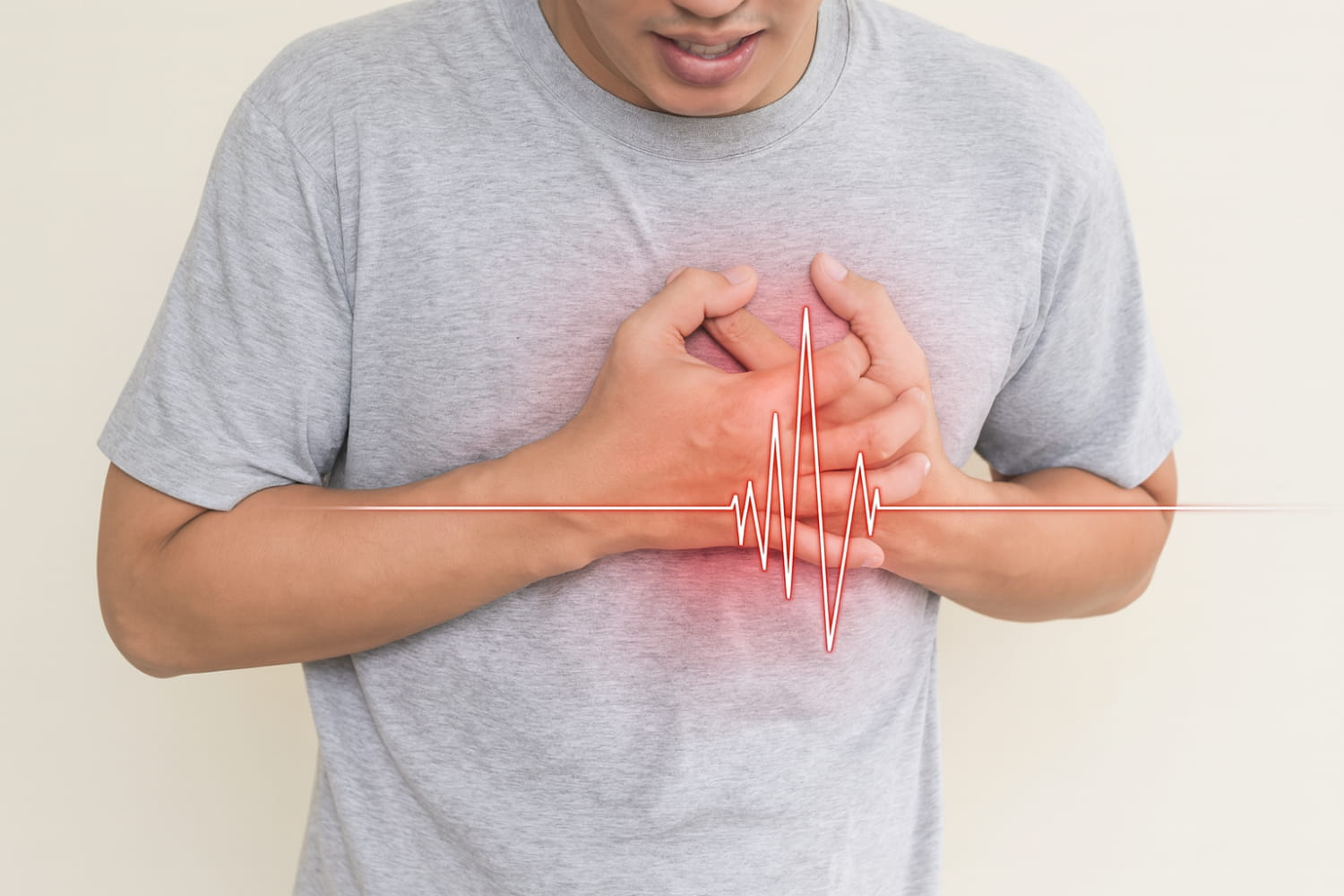 狹心症該注意什麼：醫師教你破解胸痛迷思